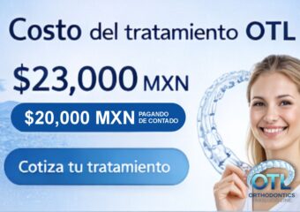 OTL LOS ALINEADORES MAS ACCESIBLES DEL MERCADO