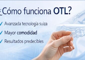 ¿CÓMO FUNCIONA OTL?