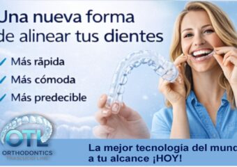 OTL ES UNA NUEVA FORMA DE ALINEAR LOS DIENTES: